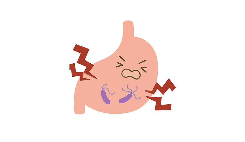 ピロリ菌に感染し、痛みを感じている胃のイラスト。赤い稲妻で炎症の様子を表現。国分寺おなかのクリニックでは、内視鏡検査でピロリ菌の有無を診断し、適切な除菌治療を行います。