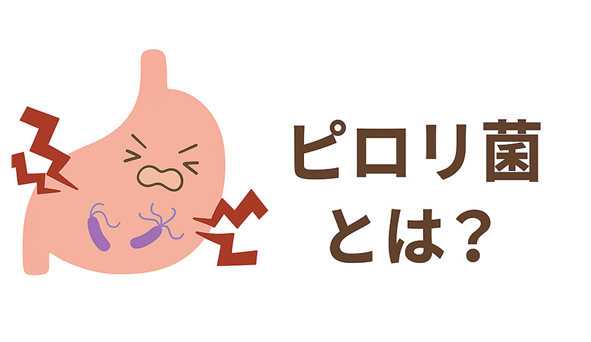 ピロリ菌に感染し、痛みを感じている胃のイラスト。赤い稲妻で炎症の様子を表現。国分寺おなかのクリニックでは、内視鏡検査でピロリ菌の有無を診断し、適切な除菌治療を行います。